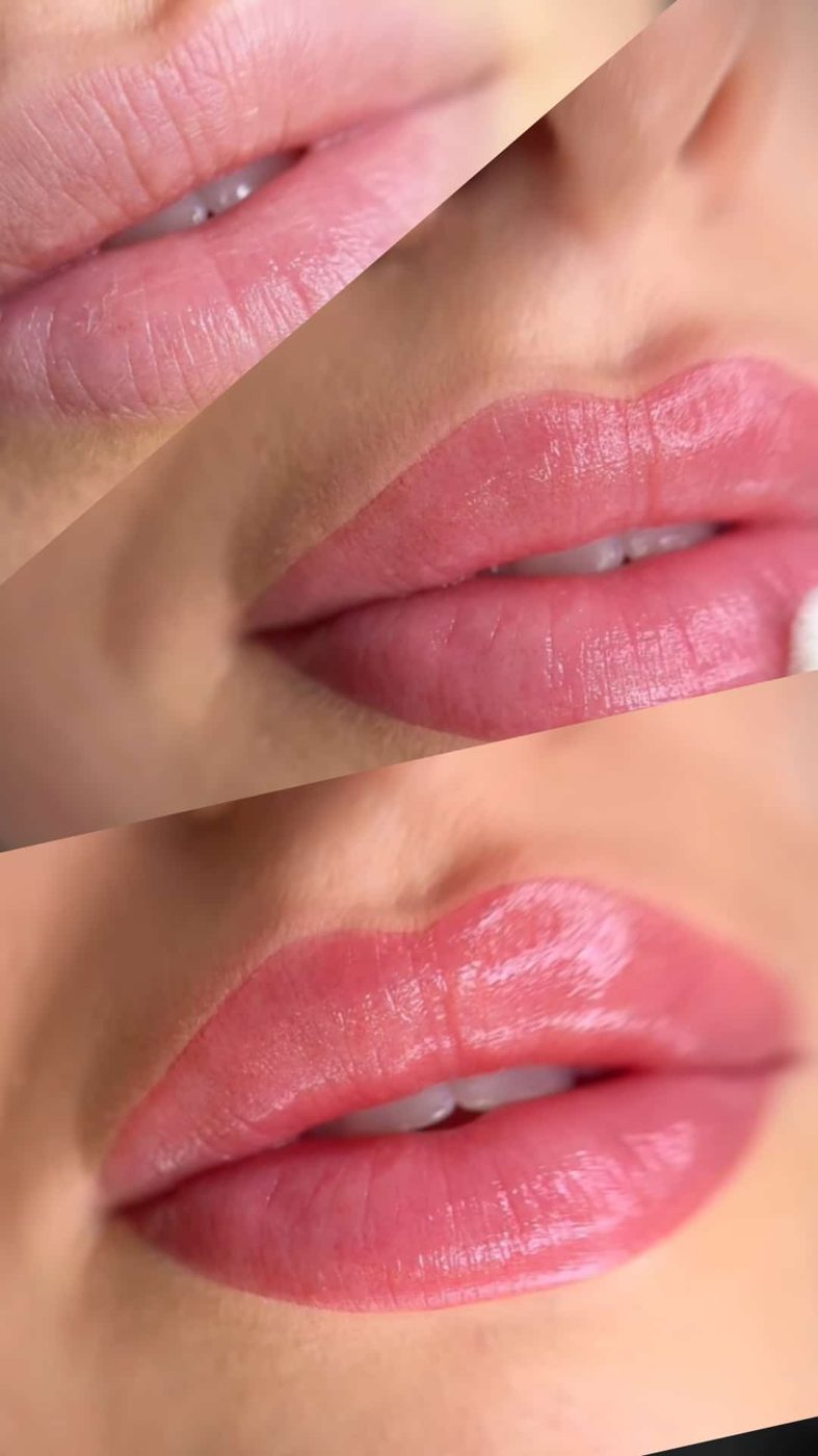 Lippenpigmentierung, Vorher und Nachher